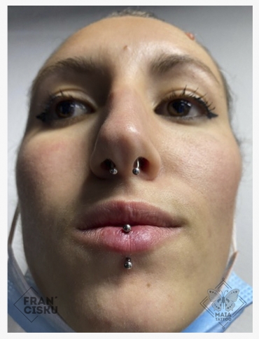 Fotografia di un viso di donna con Piercing vertical labret su labbro inferiore, con gioiello classico, eseguito da Francesco Deschino presso il Maia Tattoo di Milano Cornaredo